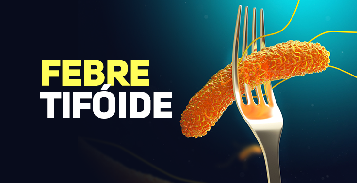 febre tifoide