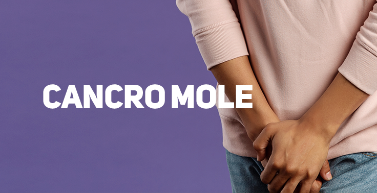 Cancro mole